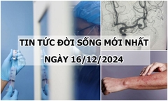 Tin tức đời sống 16/12: Hội chứng khiến bé 8 tháng tuổi bị tổn thương da nặng