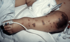 GSK đồng hành cùng Hội Y học Dự phòng tại hội thảo ra mắt sách dự phòng bệnh do não mô cầu ở Việt Nam