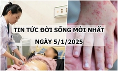 Tin tức đời sống ngày 5/1: Người phụ nữ 30 tuổi mang thai ngoài tử cung hiếm gặp