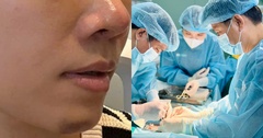 Bi hài hậu vận sau thẩm mỹ: 7 lần đụng đến dao kéo trong 6 tháng, người phụ nữ nhận cái kết đắng
