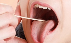 Loét miệng ba tháng không lành, đi khám phát hiện loại ung thư nguy hiểm