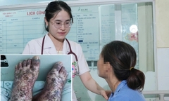 Cô gái 17 tuổi ở TP.HCM thiếu máu nặng, xuất huyết toàn thân vì căn bệnh hiếm gặp