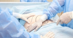 Định mệnh nghiệt ngã từ sai sót y khoa Đông-Tây: Thủng màng phổi khi phẫu thuật thẩm mỹ, cựu người mẫu tử vong thương tâm