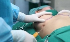 Bi hài hậu vận thẩm mỹ: Ám ảnh ngực chảy sệ sau sinh, người phụ nữ 6 lần chỉnh sửa và cái kết
