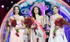 Hoa hậu Việt Nam có được phẫu thuật sau khi đăng quang không?