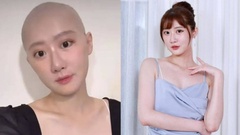 Mắc ung thư buồng trứng, nữ diễn viên trẻ chia sẻ đầy xót xa sau 6 lần hóa trị