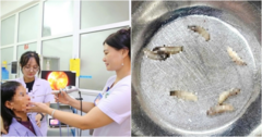 Rùng mình phát hiện ổ giòi 7 con làm tổ trong hốc mũi người phụ nữ ở Hà Tĩnh