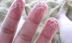 Tại sao ngón tay bị nhăn nheo khi ngâm nước lâu?