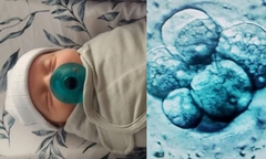 Kỳ tích y học: Em bé chào đời từ phôi thai đông lạnh năm 1994