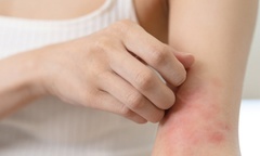 Ngứa ngáy khắp người, dấu hiệu cảnh báo gan có vấn đề, cần đặc biệt lưu ý