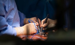 Bệnh viện mất điện đột ngột giữa ca phẫu thuật tim, nữ bệnh nhân tử vong thương tâm tại Anh