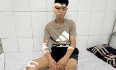 Clip: Chi tiết lời khai của đối tượng lái xe  "thông chốt ", tông CSCĐ