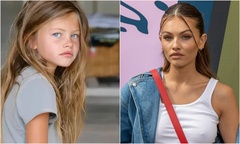 “Cô gái xinh đẹp nhất thế giới” lên tiếng về tin đồn can thiệp thẩm mỹ