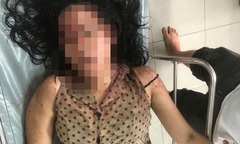 Vụ người đàn ông bắn 2 mẹ con ở Tây Ninh: Hé lộ nguyên nhân ban đầu