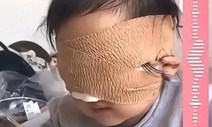 Bé gái mù cả hai mắt do thói quen nhìn chằm chằm vào điện thoại và máy tính bảng