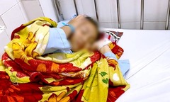 Vụ nữ sinh lớp 8 ở An Giang bị đánh hội đồng: Trường học báo cáo gì?