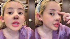 Bất ngờ với nhan sắc thời chưa phẫu thuật thẩm mỹ của Ngân 98 