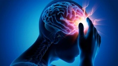  "Nguyên tắc vàng " để phòng đột quỵ