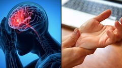 Làm thế nào để phát hiện sớm cơn đột quỵ?