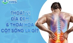 Thoái hóa cột sống & thoát vị đĩa đệm – Lý do khiến hàng triệu người Việt mắc phải