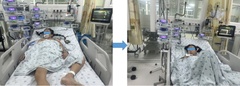 Bé gái An Giang mắc bệnh siêu hiếm, thế giới chỉ 12 ca được ghi nhận