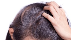 4 dấu hiệu ở tóc cảnh báo thận không khỏe