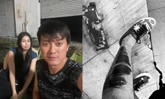 Nam diễn viên Quách Ngọc Tuyên bị tai nạn xe