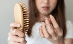 5 thói quen khiến tóc rụng đến hói đầu