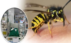  Bé gái 9 tuổi bị  "ong sát thủ " đốt hơn 50 nốt, suy đa tạng nguy kịch