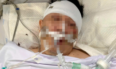 Tin tức đời sống 9/11: Tông trúng chó chạy rông, nam thanh niên ngã nguy kịch