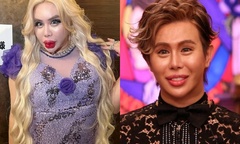 Bị bắt nạt, chàng trai "dao kéo " hơn 200 lần để thành "người đẹp nhất thế giới "