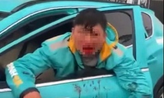 Vụ tài xế xe ôm công nghệ bị đánh thương tích ở Hà Nội: Hé lộ nguyên nhân