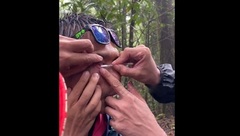 Clip: Thấy đau buốt trong mắt, kiểm tra phát hiện con vật  "đáng sợ " đang bám vào nhãn cầu