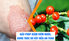 Giải pháp giảm viêm ngứa, bong tróc do vảy nến an toàn