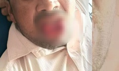 Bị cưỡng hôn, cô gái có hành động gây sốc, khiến người đàn ông mất đi  "thứ quan trọng "