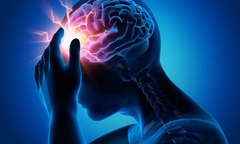 Đội mũ có liên quan đến nhồi máu não?