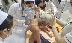 Cụ ông 74 tuổi tử vong thương tâm do ong đốt hơn 100 vết