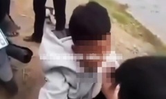 Vụ nam sinh ở An Giang bị hành hung, làm nhục: Công an vào cuộc