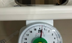 Bé 6 tuổi nhập viện vì đau bụng dữ dội, bác sĩ gắp ra thứ  "đáng sợ " 