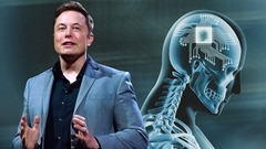 Công ty của Elon Musk tuyên bố đạt bước tiến vượt bậc trong việc cấy chip vào não người