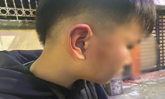 Xác minh nghi vấn bé trai ở Hà Nội bị bố của bạn hành hung