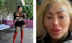 Nữ người mẫu nghiện "dao kéo " tử vong sau khi rơi từ ban công tầng 9