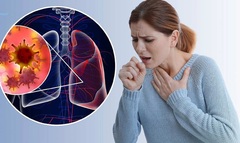 Dấu hiệu ung thư phổi giai đoạn đầu