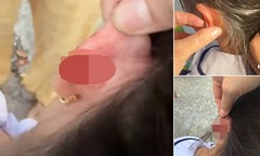 Vụ phụ huynh phản ánh giáo viên véo tai học sinh lớp 1 chảy máu: Nhà trường báo cáo gì?