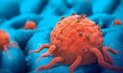 Sụt 14kg sau 3 tuần  "bỏ đói " ung thư, bệnh nhân suy kiệt, bác sĩ cảnh báo  "nóng "