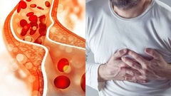  "Thủ phạm " gây ra tình trạng cholesterol cao