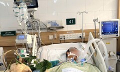 Diễn biến vụ 6 người trong gia đình ngộ độc do ăn hạt cây củ đậu tỉnh Ninh Bình