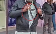 Clip: Bị rắn hổ mang cắn, nam tài xế có hành động khiến cả bệnh viện khiếp vía