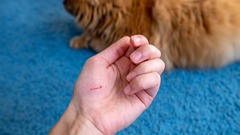 Tin tức đời sống 16/1: Bị mèo cào, người đàn ông TP.HCM tử vong thương tâm