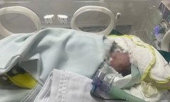 Trẻ sơ sinh bị bỏ rơi đã ngừng tim, người đầy bùn đất được  "hồi sinh " kỳ diệu